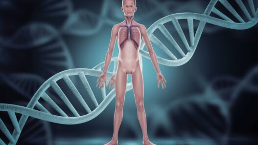 Czym jest zespół marfana